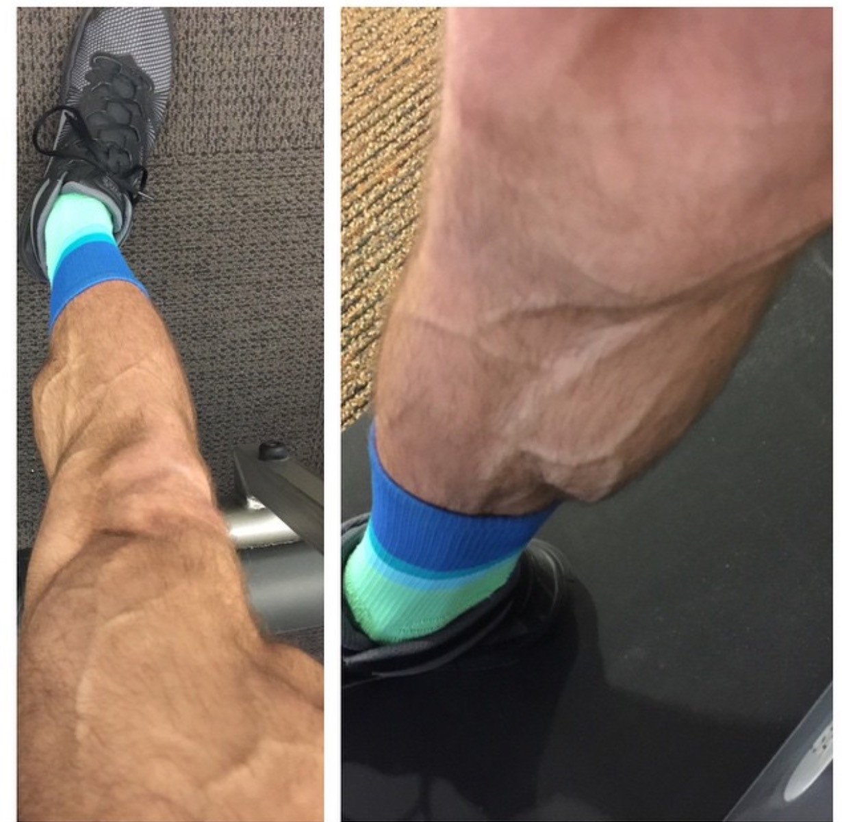 Leg Pump & Burn Out